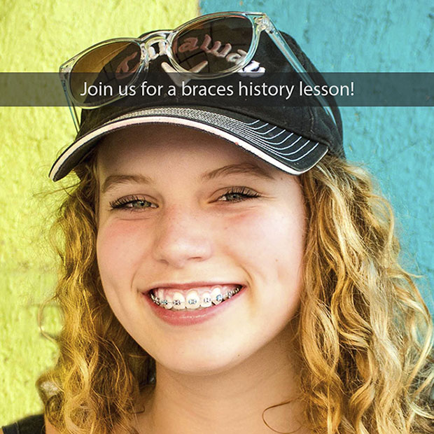 Join Us for a Braces History Lesson! Markham ON Markham Orthodontic