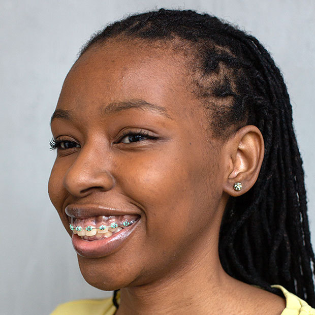 What Are the Different Parts of Braces For? Markham ON Markham